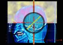 Braintimeframe